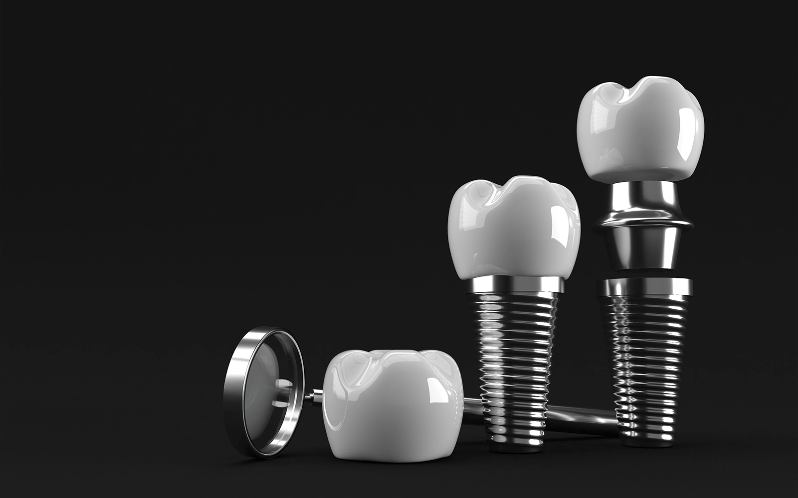 インプラントの構造と種類