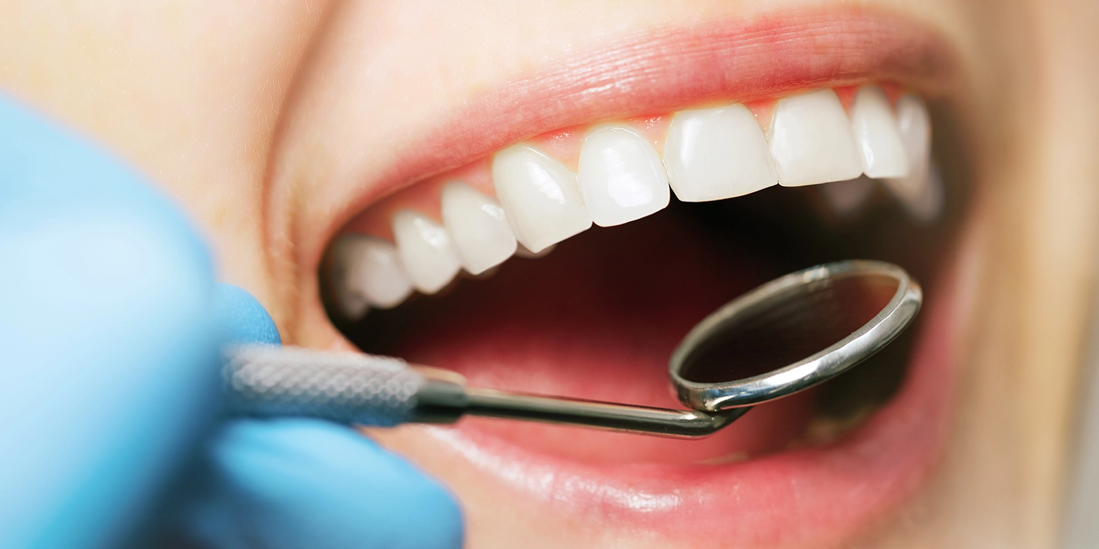 メンテナンス・予防