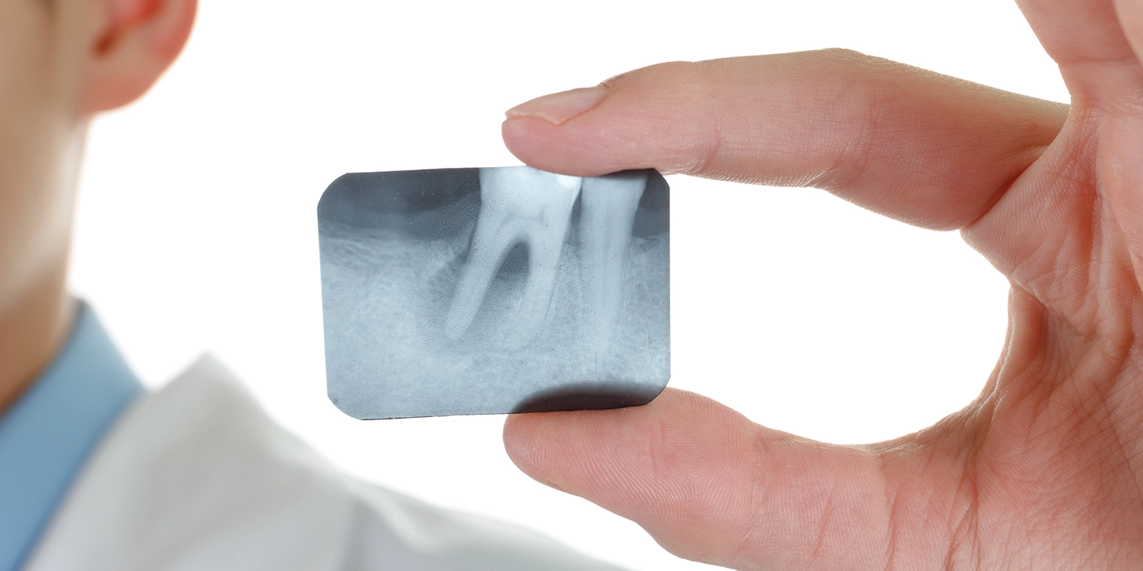 歯周病と全身疾患の関係