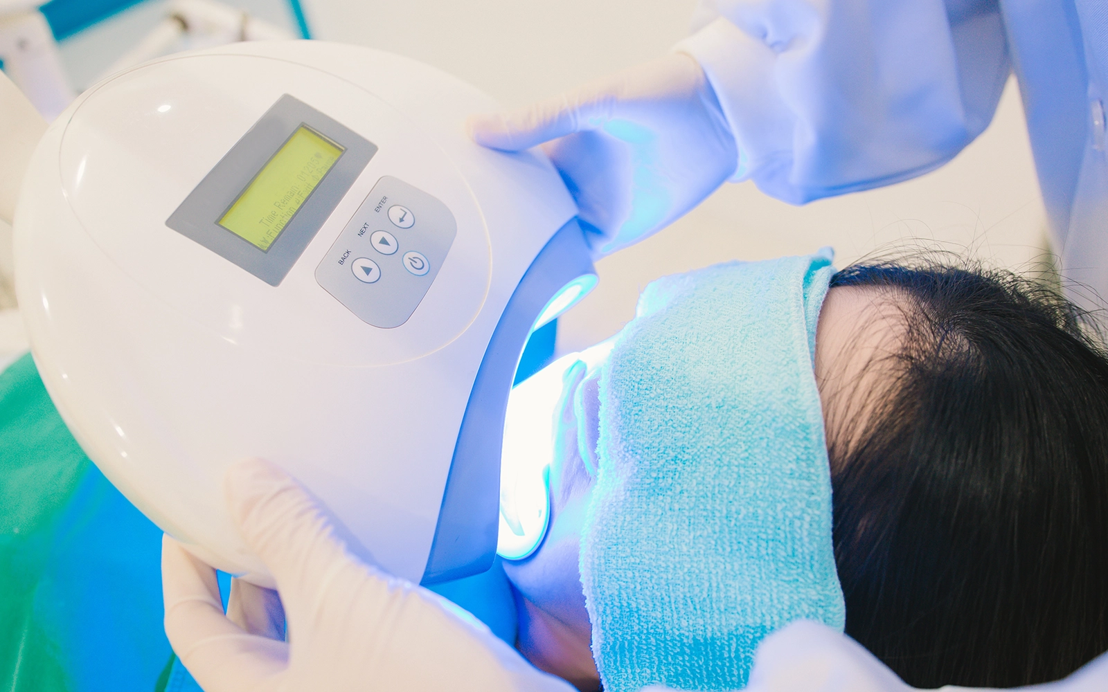 オフィスホワイトニング